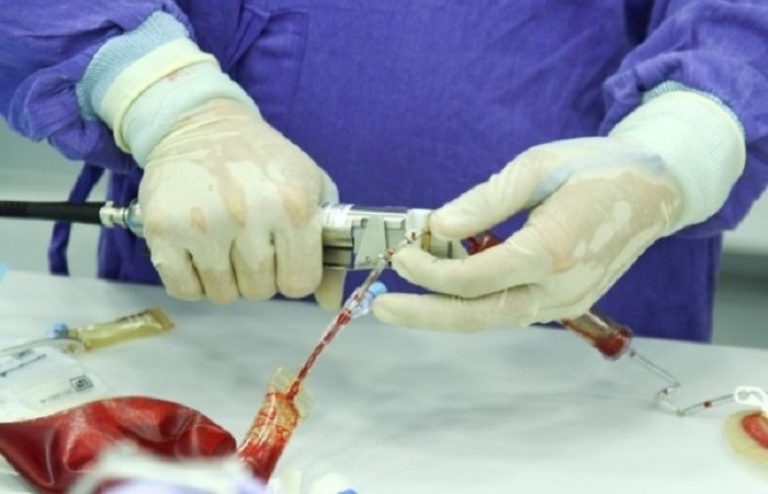 bác sĩ chiết tách tế bào gốc máu cuống rốn để lưu trữ